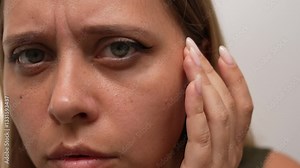 A young concerned woman gently touches the skin under her eyes, showing visible dark circles and puffiness. Her close-up expression reveals tiredness, under-eye swelling and a desire for care and rest