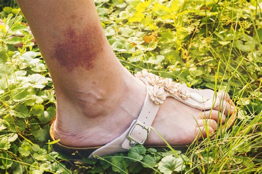 Insights From the Field: Treating Lyme Disease and Other Tick-Borne Illnesses