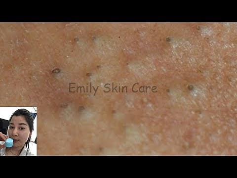 Most Satisfying Video Face Skin Care with Calm Music Ep66