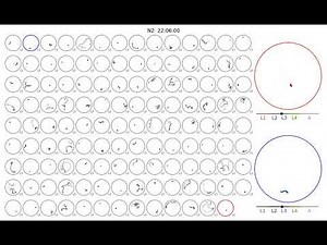 The Lifetime Movement of Nematodes