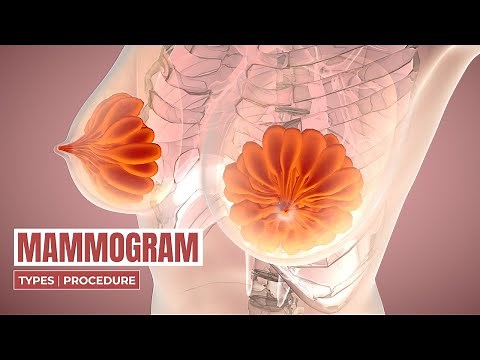 What is a Mammogram? | Breast Cancer | Types, Symptoms & Procedure | 3D Animation