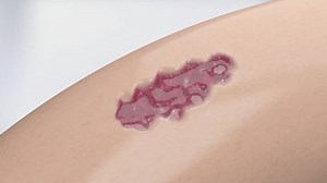 Skin Scar Repair Essence Gel Repair Stock Footage Video (100% Royalty-free) 3791850505 | Shutterstock