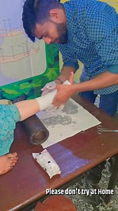 1.8K views · 26 reactions | Ankle fracture: Medial malleolar : Treatment | 퐇퐞퐥퐥퐨 퐔퐩퐜퐡퐚퐫 | Facebook