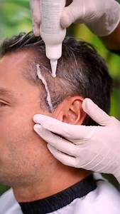 Tratamiento capilar Con #Nioxin Scalp Renew! Un tratamiento de...