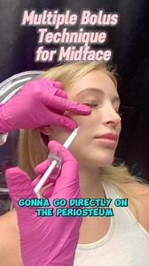 4.5K views · 10 comments | Do you know how to do the multiple bolus...