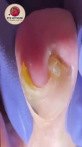 3.6K views · 30 reactions | Foot Health Guide for Diabetic Daily Comfort  #SeniorCare #DiabeticFootCare #HealthyHabits | Bye | Facebook