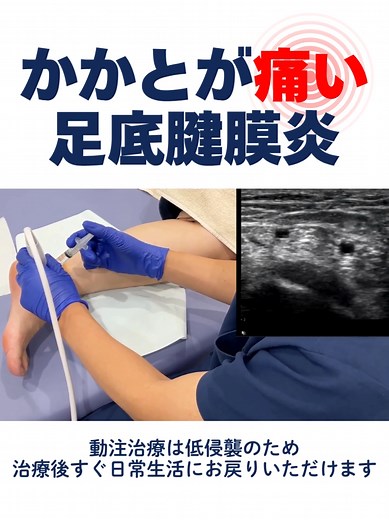 かかとの痛みの原因と治療法