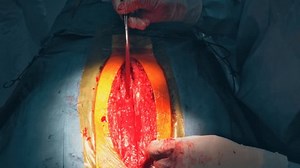 There Requirement Chest Dissection Prior Performance Stock Footage Video (100% Royalty-free) 1100894931 | Shutterstock