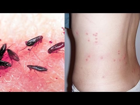 3 Best Way To Get Rid Of Fleas In The House - How To Kill Fleas In 12 Hours