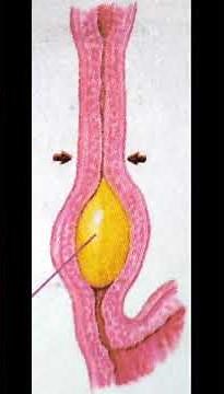 Peristaltic movement | How does the food move in the food pipe