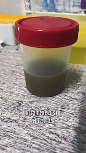 Px fem. 84 años #labclinico #uroanalisis #ego #bacterias | LabClass