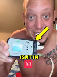 He’s Literally Holding His Own HEART! Imagine having no pulse and carrying your heart's power source in your hand 24/7. Would you be able to sleep with a machine keeping you alive? Let me know in the comments! 👇 #artificialheart #lvad #medicalmarvels #heartfailuresymptoms #cyborg #didyouknow