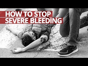 How to Stop Severe Bleeding #FirstAid #Lifesaver