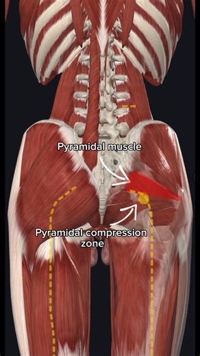 19K views · 189 reactions | These are the different areas of compression of the sciatic nerve, the pain they generate and how to solve it #physiotherapy #pain #sciatic #rehab | Global Fisio | Facebook