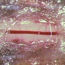 Video: Implanting Glass Spinal Cord Windows in Adult Mice with Experimental Autoimmune Encephalomyelitis