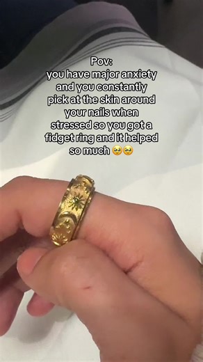 Spinning Anxiety Ring: A Unique Stress Relief Tool