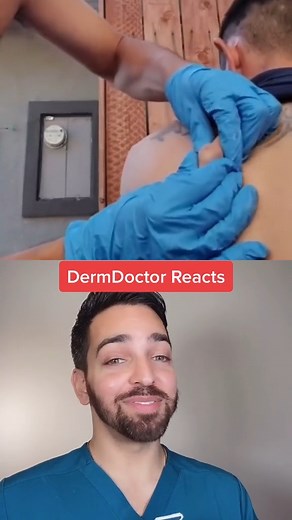 #pimplepopping #dermdoctor | Doctorly