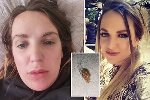 Beautician whose dyed eyebrows FELL OFF warns you should never skip patch tests