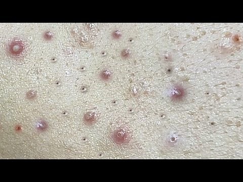 Satisfying With Loan Nguyen Spa Video #008