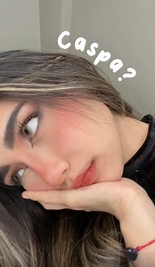 1.4K views · 223 reactions | COMO CURAR LA CASPA‍♀️: Médico te explica #caspa #cuerocabelludo #fyp #tipscabello | Doctora Dany | Facebook