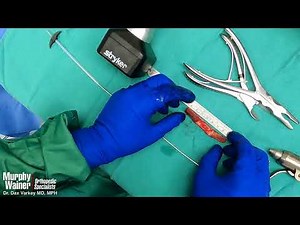 ACL Reconstruction with Patellar Tendon Autograft