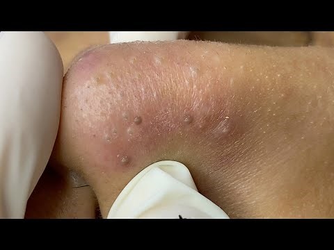 Relax Every Day With Sac Dep Spa #0255