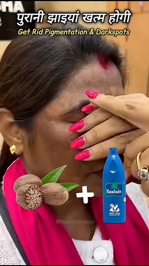 7.5M views · 14K reactions | clean Dark spots & Pigmentation Naturally At Home Get Fair & Clearskin#beautytips#diy | anjanaverma.19 | Facebook