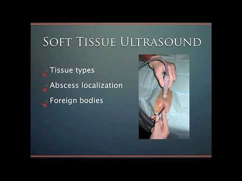 Soft Tissue Ultrasound