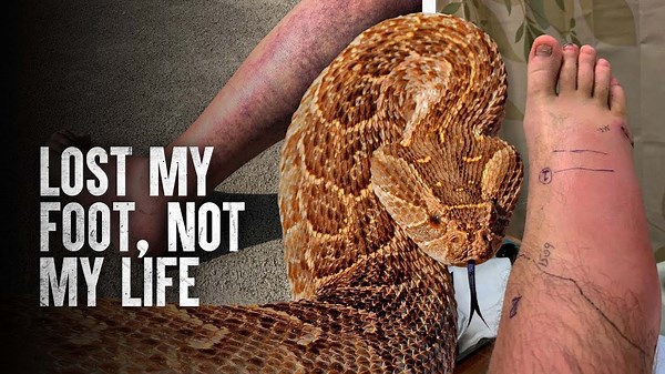 Surviving the Worst Snake Bites: What You Need to Know