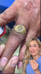 283K views · 1.2K reactions | Til death do they part  #ring #funfact #healthfacts #doctor #doctors #doctorsoftiktok #medicine #medical #medicalhumor #medicalvideos #surgery #nurse #nurses #podiatry #podiatrist #podiatric #surgeon #surgeons #healthcare #scrublife | Footdocdana | Facebook