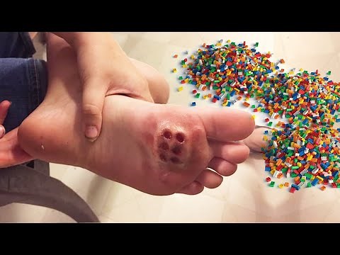 i stepped on a lego..
