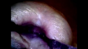 endoscope full inside cock urethra with ejac-inner aventure