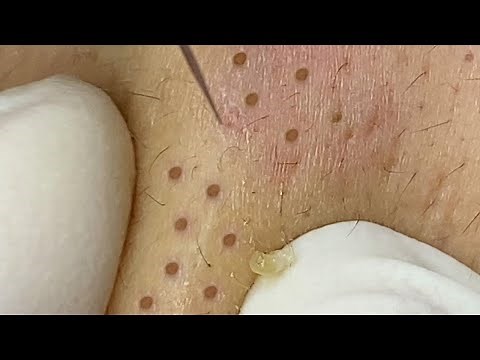 Satisfying Relaxing with Sac Dep Spa Video (#271) #SacDepSpa