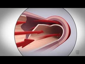 Mayo Clinic SCAD Research Program Update: 2015