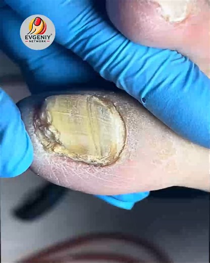 Professional Nail Advice for Dry Cuticles With Lasting Results #SimpleNailCare #HealthyNails #NailCareTips #CleanNailsDaily | Evgeniy