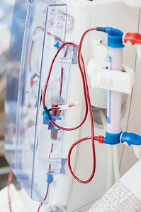 [Hot Item] Medical Low Flux and High Flux Blood Hemodialysis Dialyzer