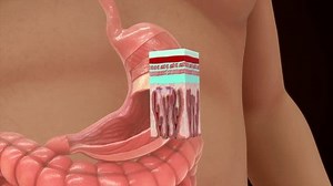 Gastric Chief Cell Zymogenic Cell Peptic Stock Footage Video (100% Royalty-free) 3459732077 | Shutterstock