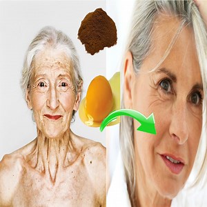 2.8K views · 82 reactions | 100 year old recipe - old girl no matter your age ~ Thank Me Later | Health Tips | Facebook