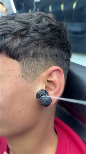 The removal of the blackhead from ear😳✂️ #fyp #foryou #foryoupage #viral #explore #comedy #asmr