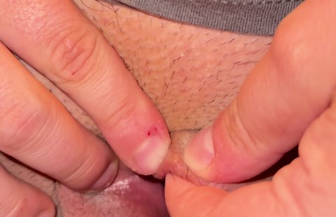 explosive audible pop on labia (nsfw)