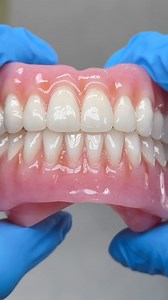 4.4K views | Amazing Process Dentures! Case from Dr. Chris Davenport in Virginia! | CEO Luke Kahng | Facebook