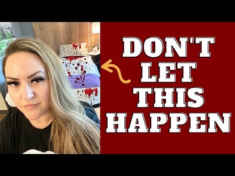 How To Prepare For BBL Surgery || BBL Journey || Tips for Lipo 360 + BBL