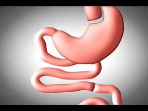 Sentara Weight Loss Surgery Center at Sentara Northern Virginia Medical Center