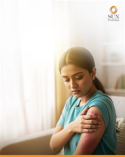 3.7K views · 124 reactions | The signs of psoriasis may be visible on the skin, yet its impact is felt much deeper. Recurring flare-ups can cause discomfort, affect confidence, and interfere with daily routines. This Psoriasis Awareness Month is a reminder to recognise psoriasis as a chronic condition that requires long-term care supported by medical guidance. hashtag#SunPharma hashtag#PsoriasisAwarenessMonth | Sun Pharmaceutical Industries Limited | Facebook