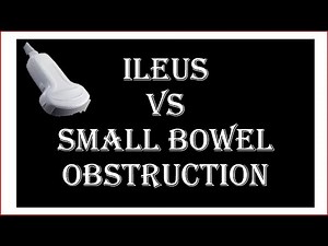 Ultrasound of ileus VS small bowel obstruction