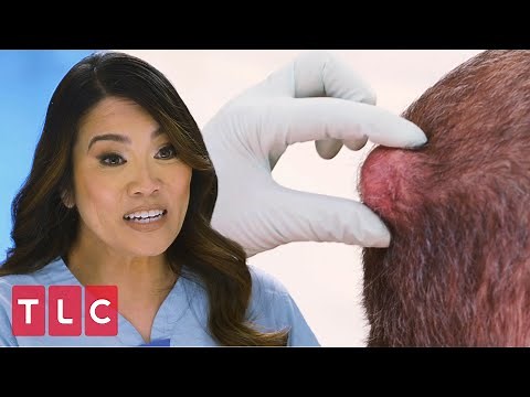 "Sometimes These Squirt at Me" | Dr. Pimple Popper