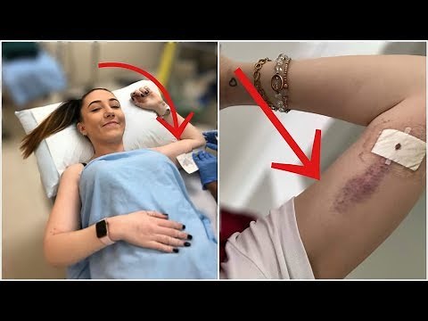 ♡ Getting a Implant In my Arm! *On Camera* | Amy Lee Fisher ♡