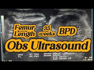 Fetal Gender Reveal | Obstetrics Ultrasound | 35 weeks Gender Scan | Baby Gender Male Female