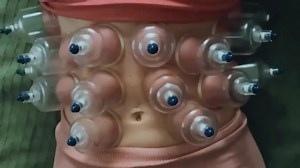 Ribs can be restricted this causes difficulty breathing and back/shoulder pain. | Greater Therapeutics