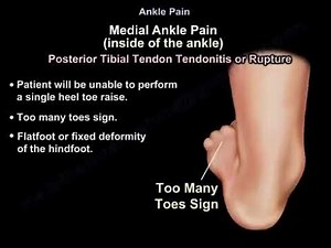 Ankle Pain: Causes, Symptoms, and Treatment • Video • MEDtube.net